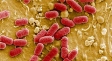 e.coli.jpg
