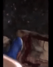 flayed.gif