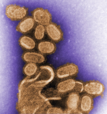 1918-flu-color-11098.jpg