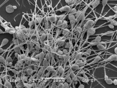 1200px-Human_Spermatozoa_Scanning_Electron_Micrograph.jpg