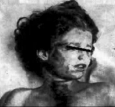 mary-phagan-autopsy-photo-1913.jpg