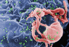 hiv-aids-virus.jpg